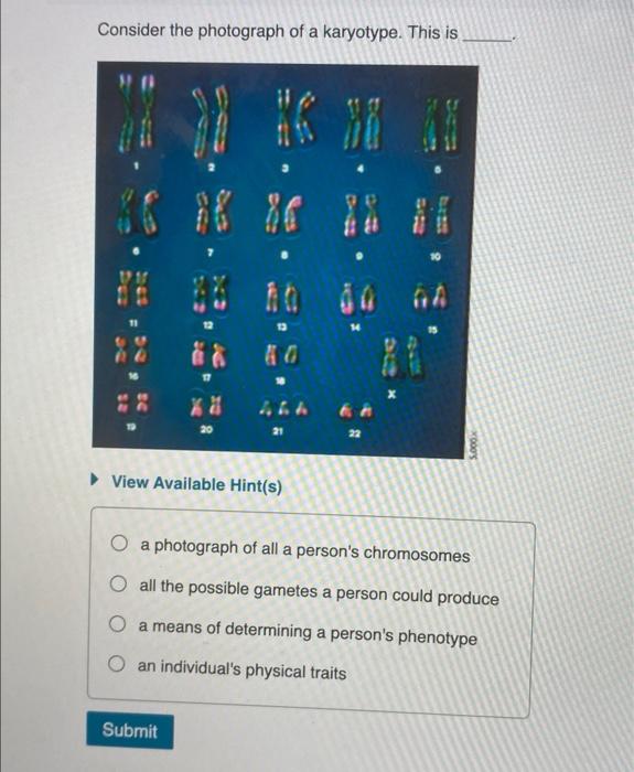Solved Consider the photograph of a karyotype. This is-a | Chegg.com