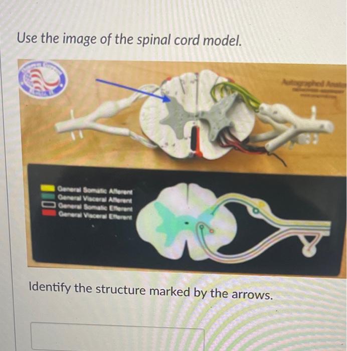 Solved Use the image of the spinal cord model. General | Chegg.com