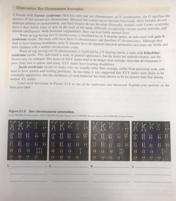 Solved Observation Sex Chromosome Anomalies A Female With