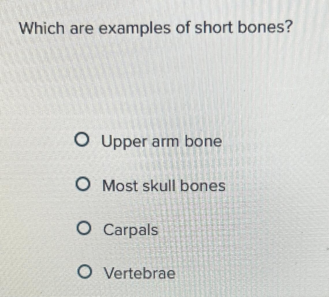 Solved Which are examples of short bones?Upper arm boneMost | Chegg.com