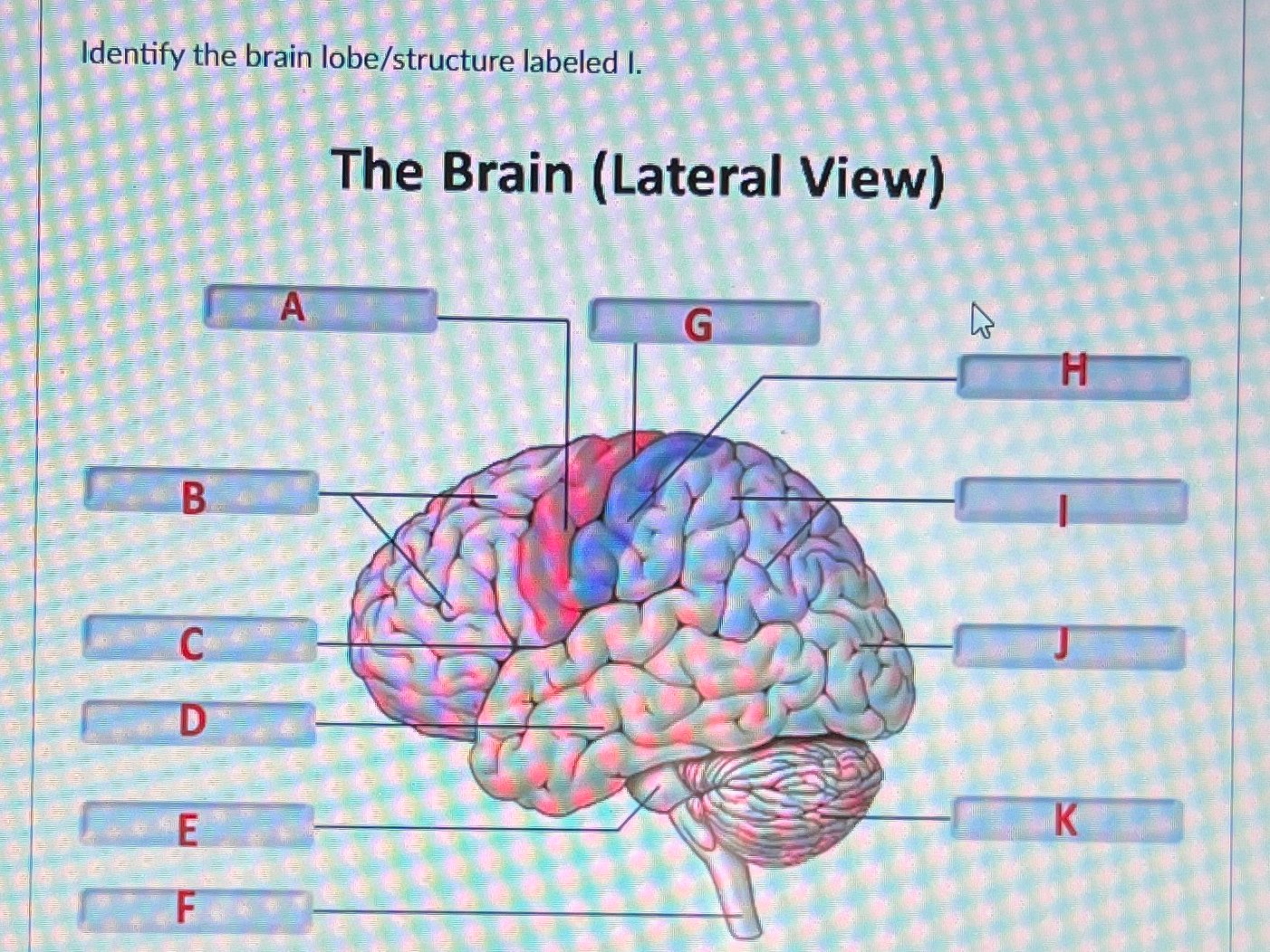 Solved Identify the brain lobe/structure labeled I.The Brain | Chegg.com