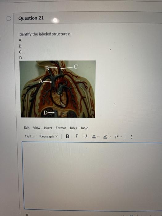 Solved D Question 21 Identify The Labeled Structures: A. B. | Chegg.com