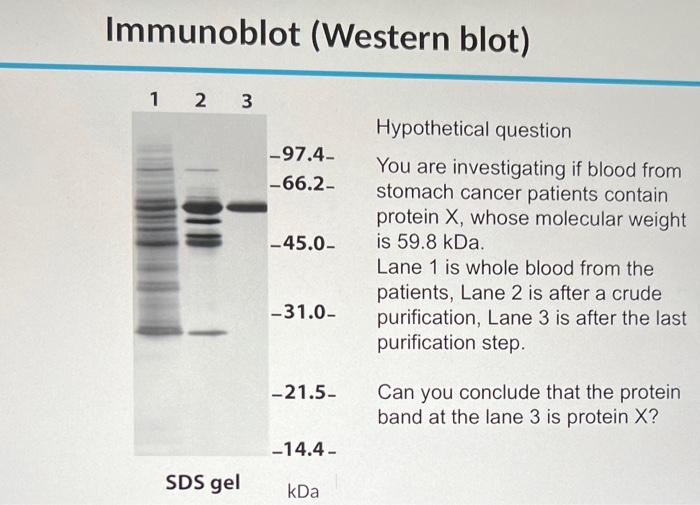 Solved Immunoblot (Western Blot) | Chegg.com