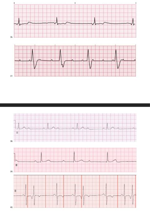 Identify thr ECG strip | Chegg.com