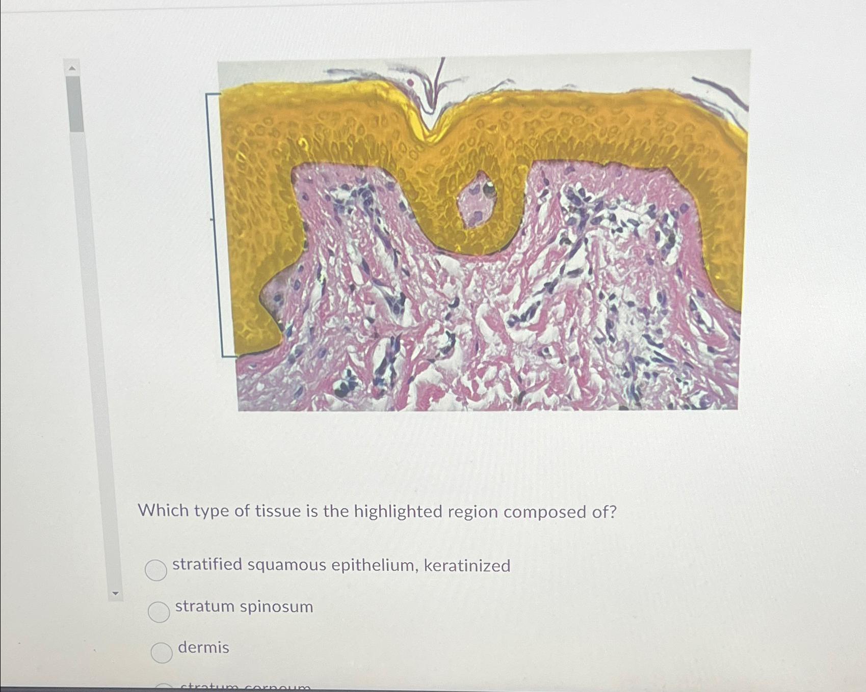 Solved Which type of tissue is the highlighted region | Chegg.com