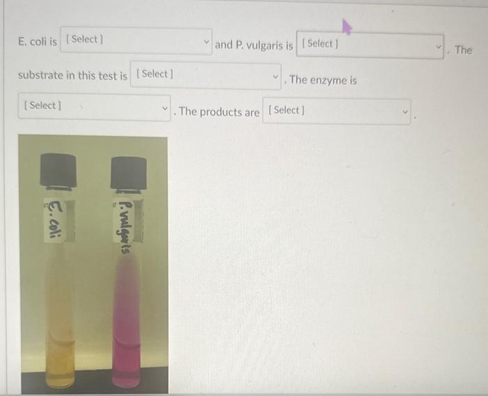 Solved E.coli is negative or positive?P. vulgaris is | Chegg.com