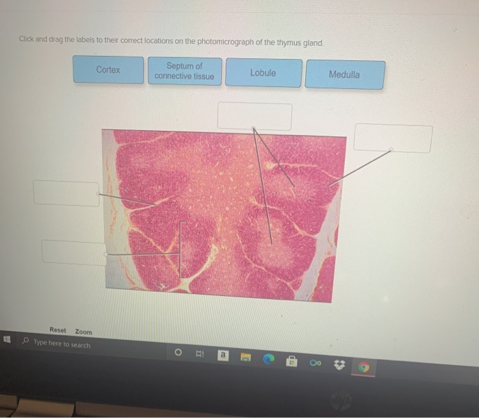 Solved Click and drag the labels to their correct locations | Chegg.com