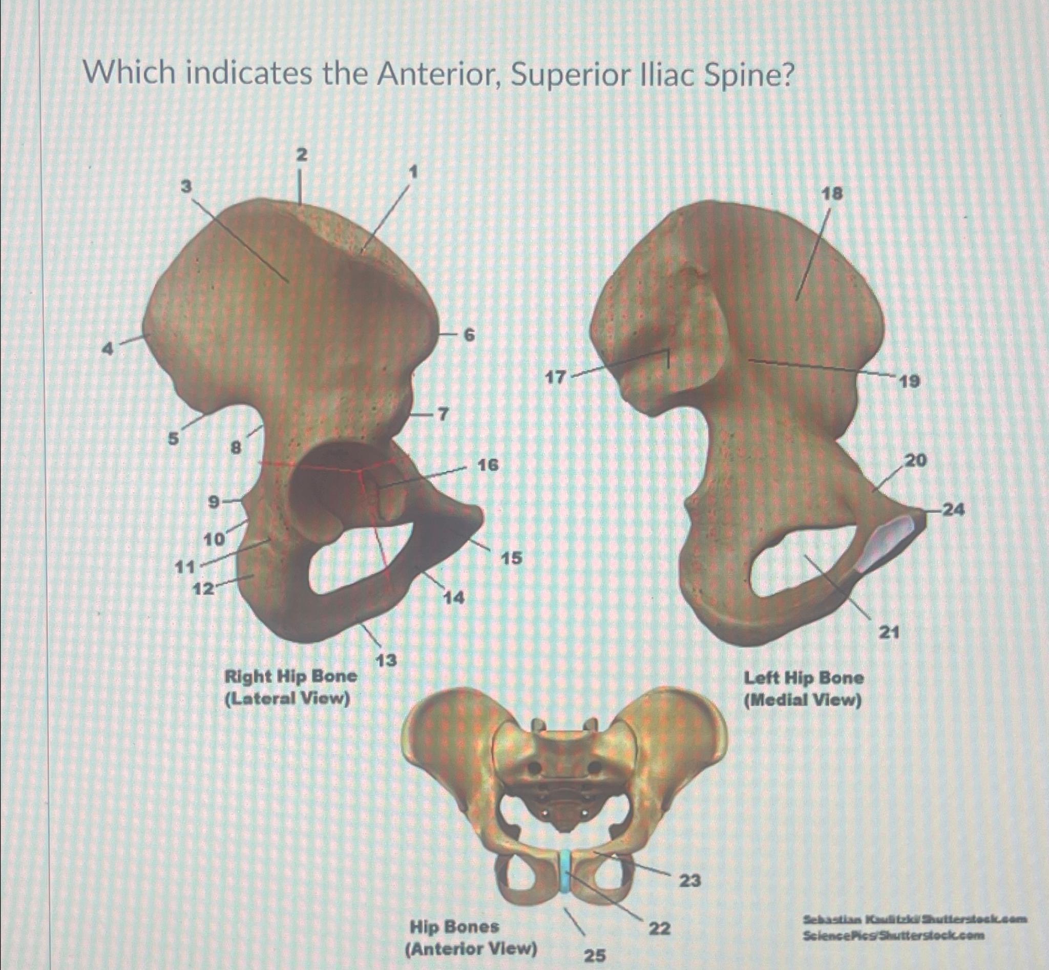 Solved Which indicates the Anterior, Superior Iliac Spine? | Chegg.com