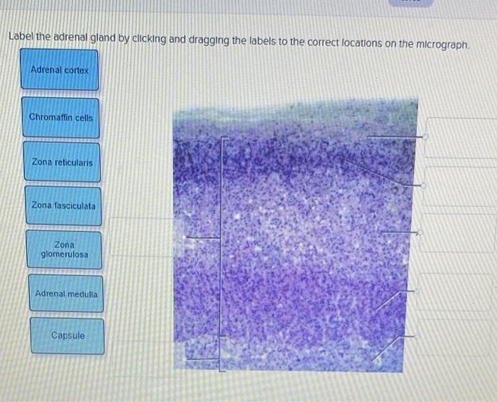 Solved Label the adrenal gland by clicking and dragging the | Chegg.com