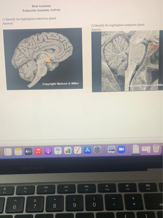 Solved Real Anatomy Endocrine Anatomy Activity 1) Identify | Chegg.com