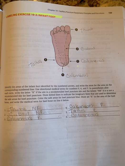 Solved Chapter 10 Capillary Puncture f ING EXERCISE 102