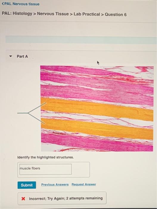 Solved Nervous Tissue > Lab Practical > Question 6 Part A