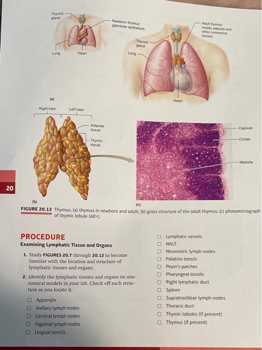 Thyroid gland Newbom thymus glandular epithelium | Chegg.com