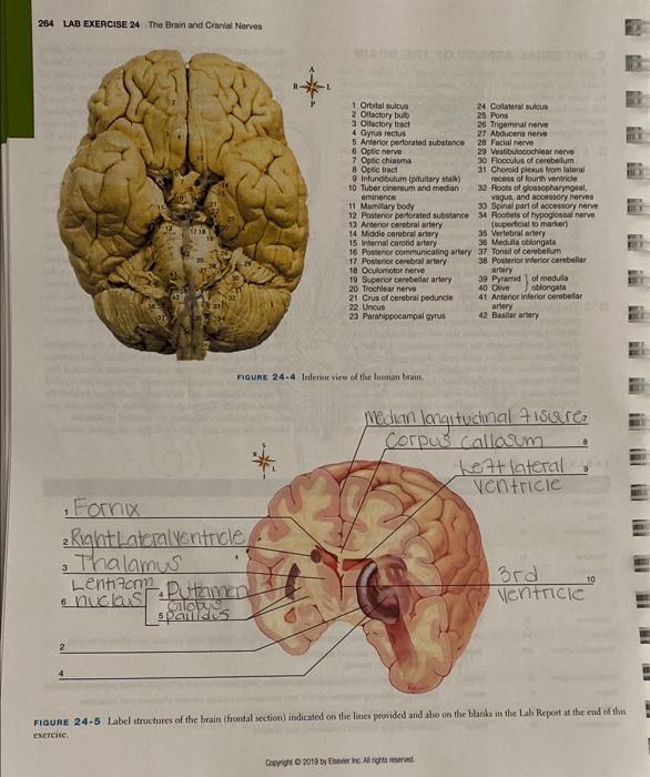 Solved 264 LAB EXERCISE 24 The Brain and Cranial Nerves 32.