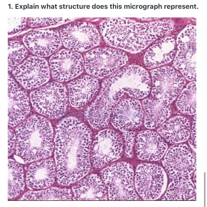 Solved 1. Explain what structure does this micrograph | Chegg.com