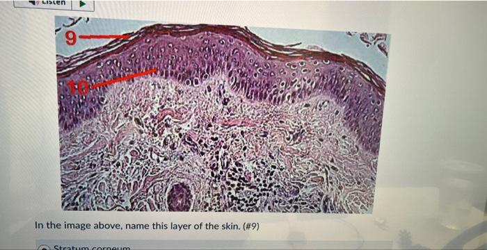 Solved name this layer of the skin #9stratum corneum | Chegg.com