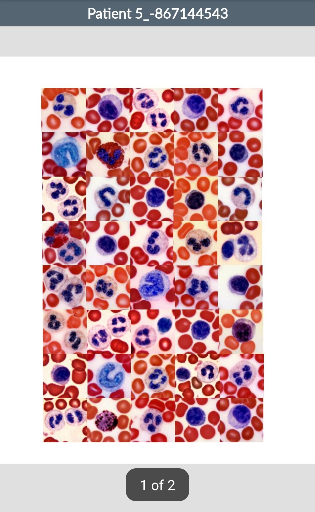 Solved Differential White Blood Cell Count You will be