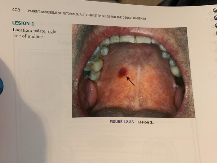 Solved 408 PATIENT ASSESSMENT TUTORIALS A STEP BY STEP Chegg