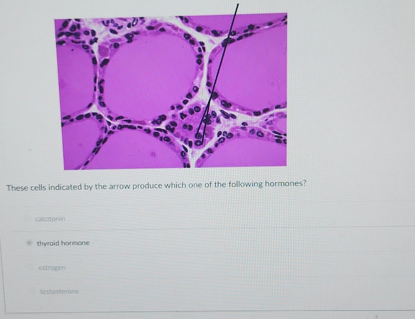 solved-these-cells-indicated-by-the-arrow-produce-which-one-chegg