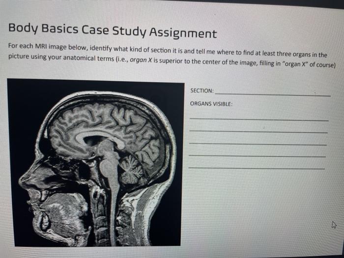 Solved Body Basics Case Study Assignment For each MRI image | Chegg.com