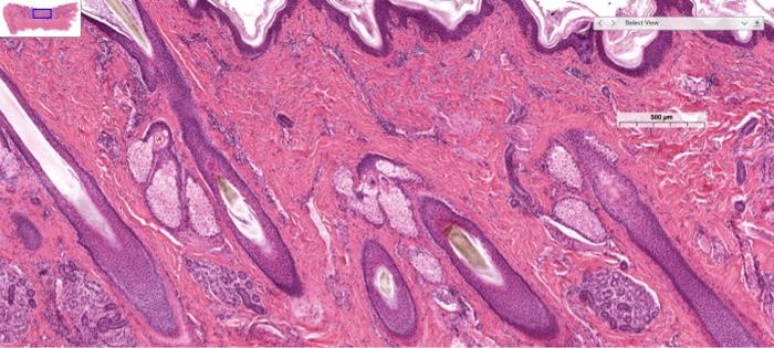 Solved could you please label the sebaceous glandmerocrine | Chegg.com