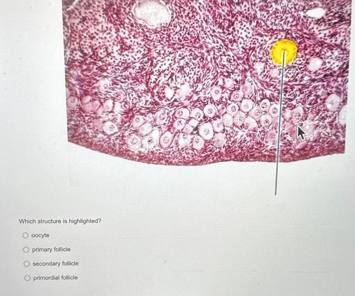 Which structure is highlighted?
oocyte
primary follicle
secondary follicle
primordial follicle