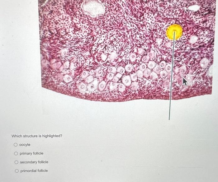 Which structure is highlighted?
oocyte
primary follicle
secondary follicle
primordial follicle