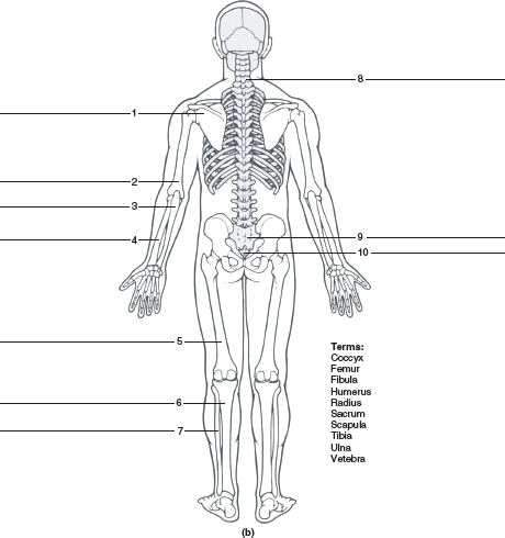 Solved: Label the bones indicated in figure 13.3.Figure 13.3 La