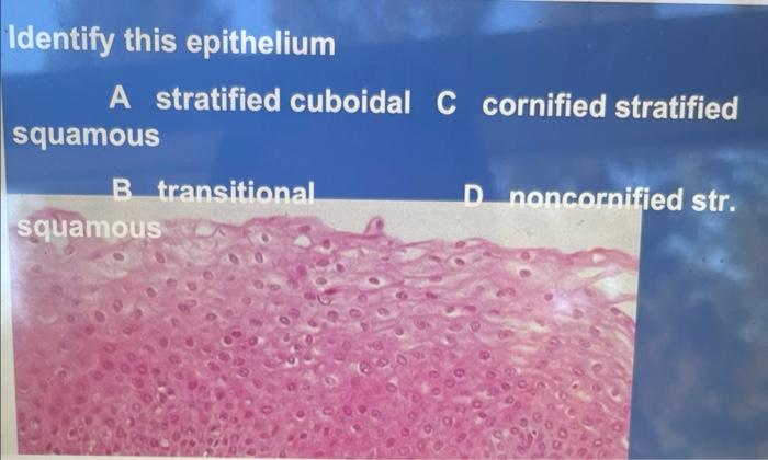 Solved Identify this epithelium A stratified cuboidal C | Chegg.com