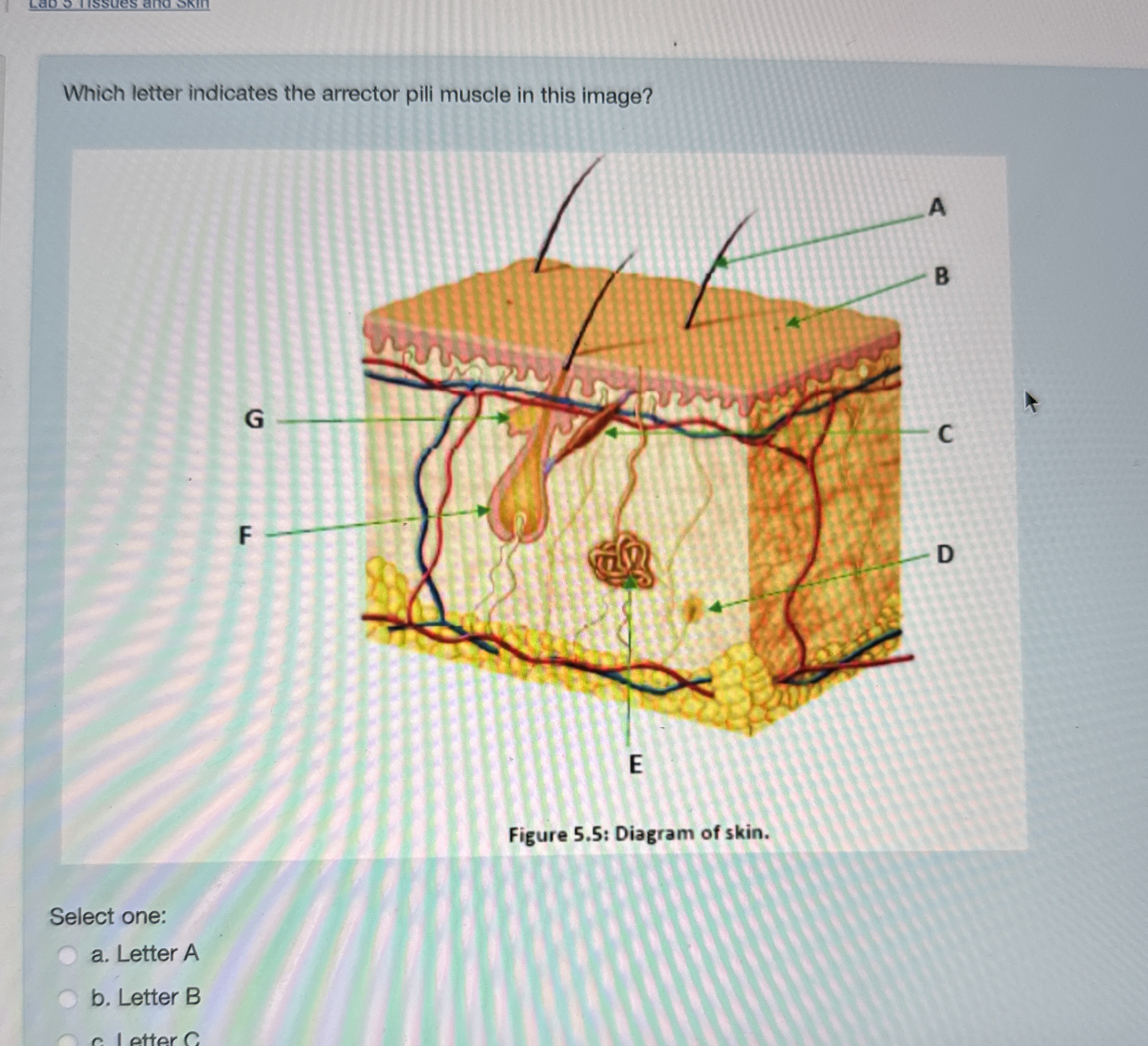 Solved Which letter indicates the arrector pili muscle in | Chegg.com