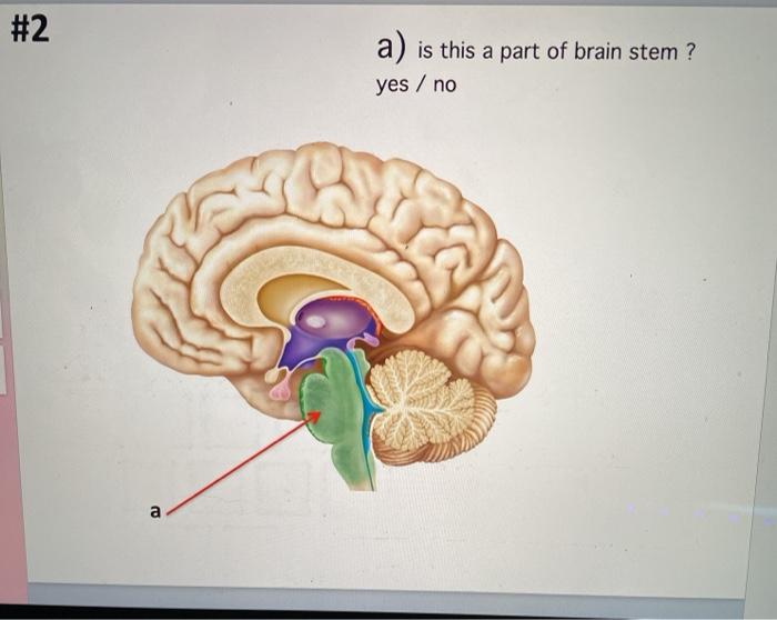 Solved #1 a) Name the elevated ridges b) Name the lobe a b | Chegg.com