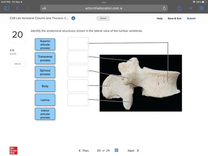 Solved Correctly Label The Anatomical Features Of The Rib | Chegg.com