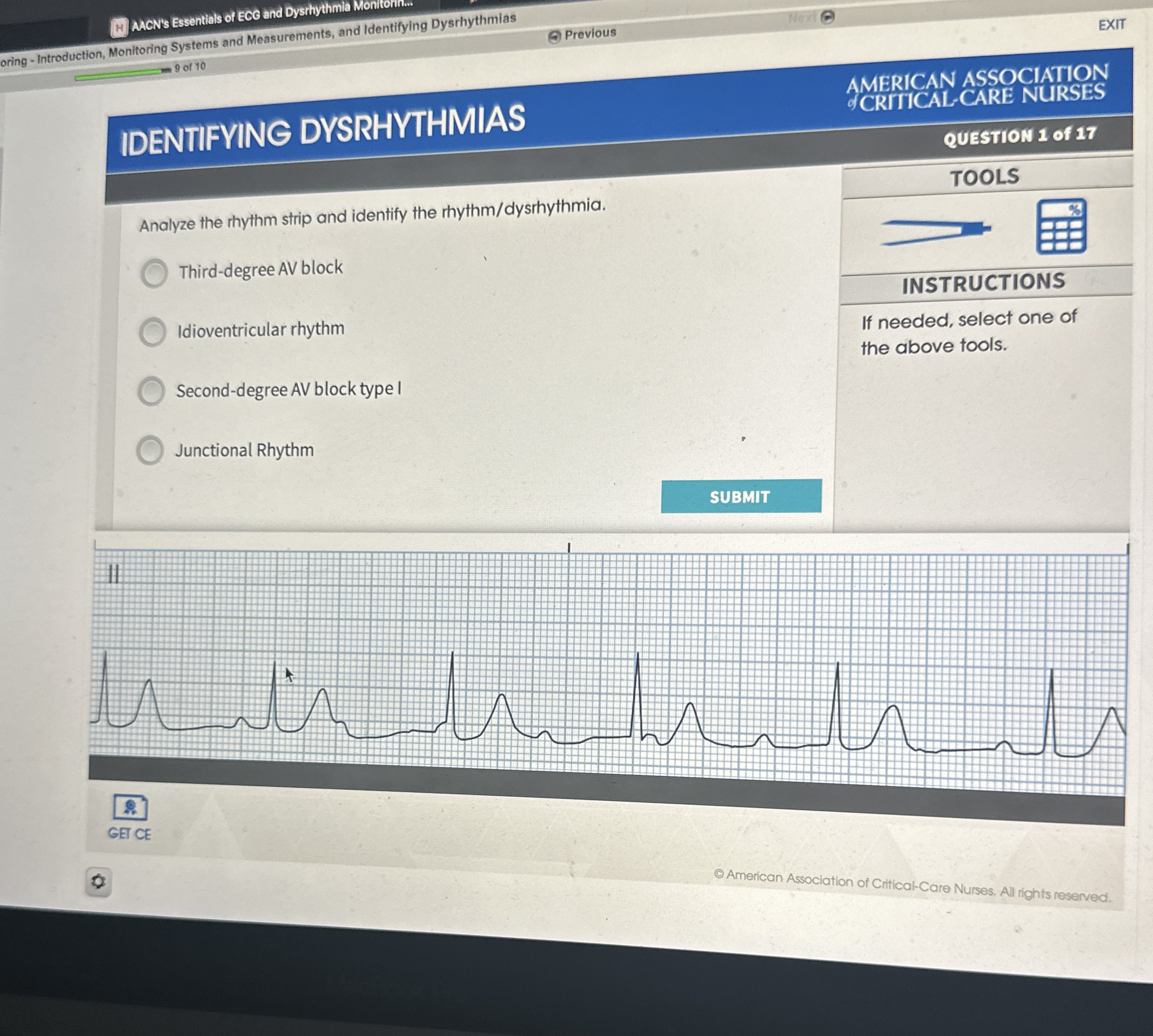 Solved ACW's Essentials of ECO and Dysrhythmia | Chegg.com