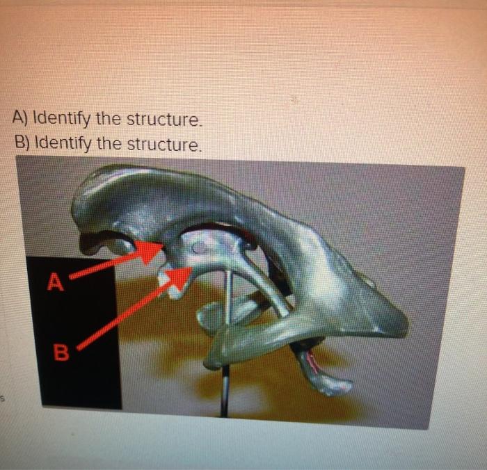 A) Identify The Structure. B) Identify The Structure. | Chegg.com