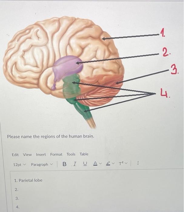 Solved Please name the regions of the human brain. | Chegg.com