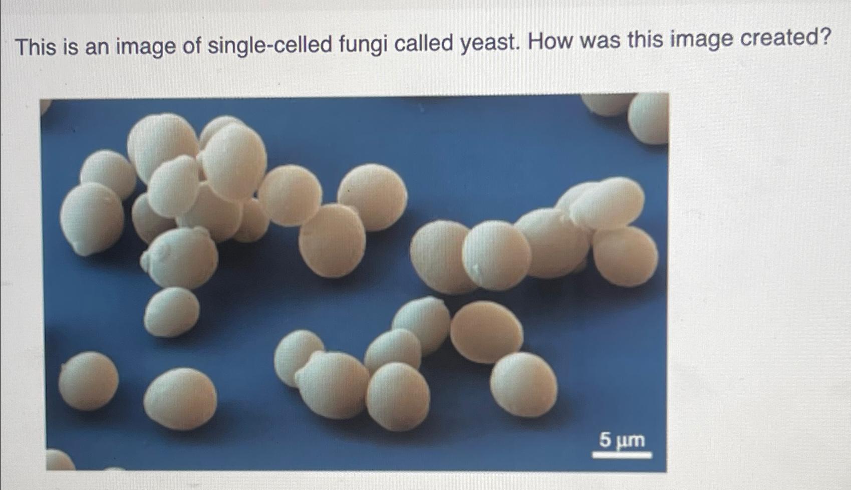 Solved This is an image of singlecelled fungi called yeast.