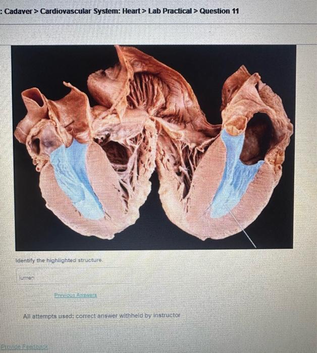 Cadaver > Cardiovascular System: Heart> Lab Practical > Question 11
Icientify the hightightedistruoture.
lumet?
Allattempts u