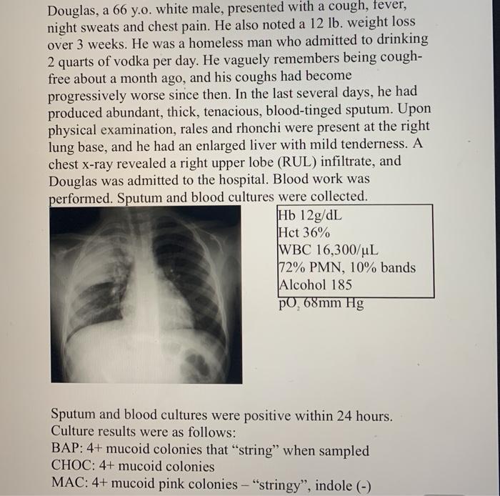 Douglas, a 66 y.o. white male, presented with a cough, fever, night sweats and chest pain. He also noted a 12 lb. weight loss