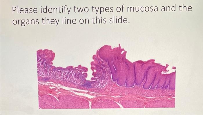 Please identify two types of mucosa and the organs they line on this slide.