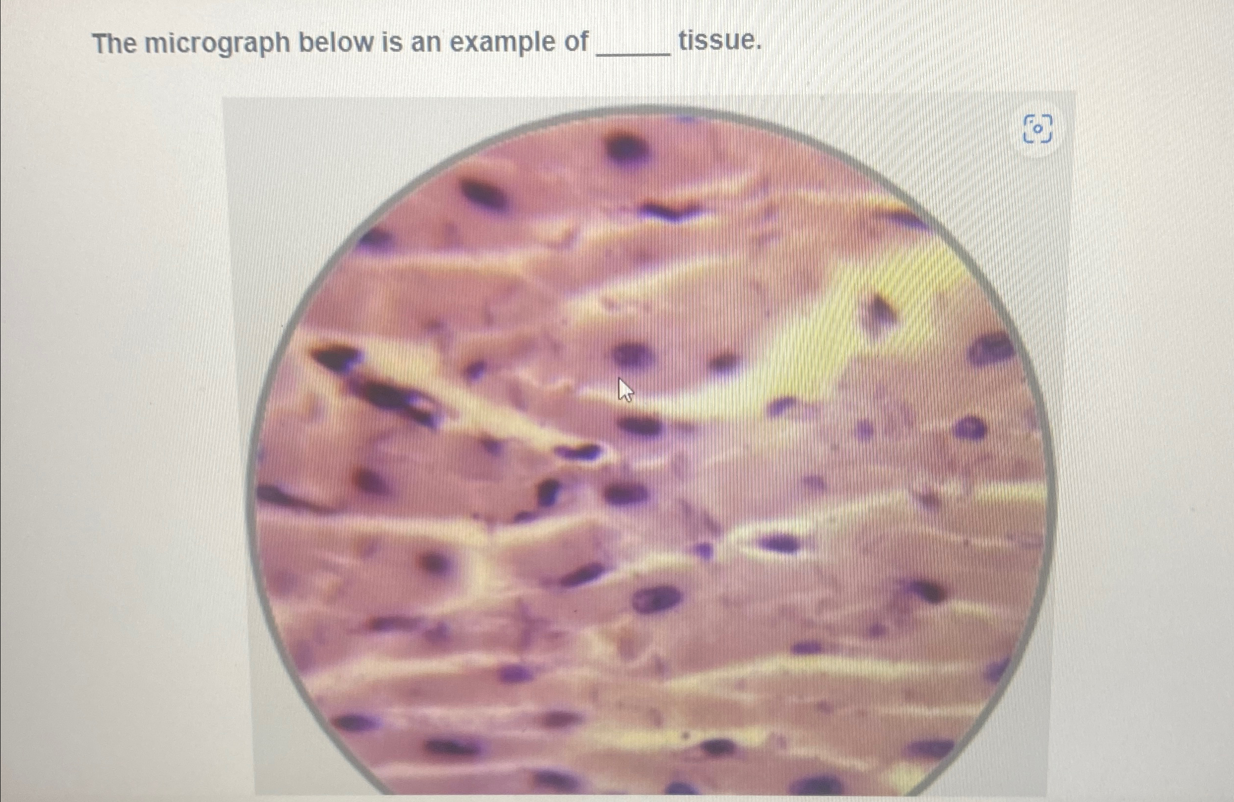 Solved The micrograph below is an example of tissue. | Chegg.com