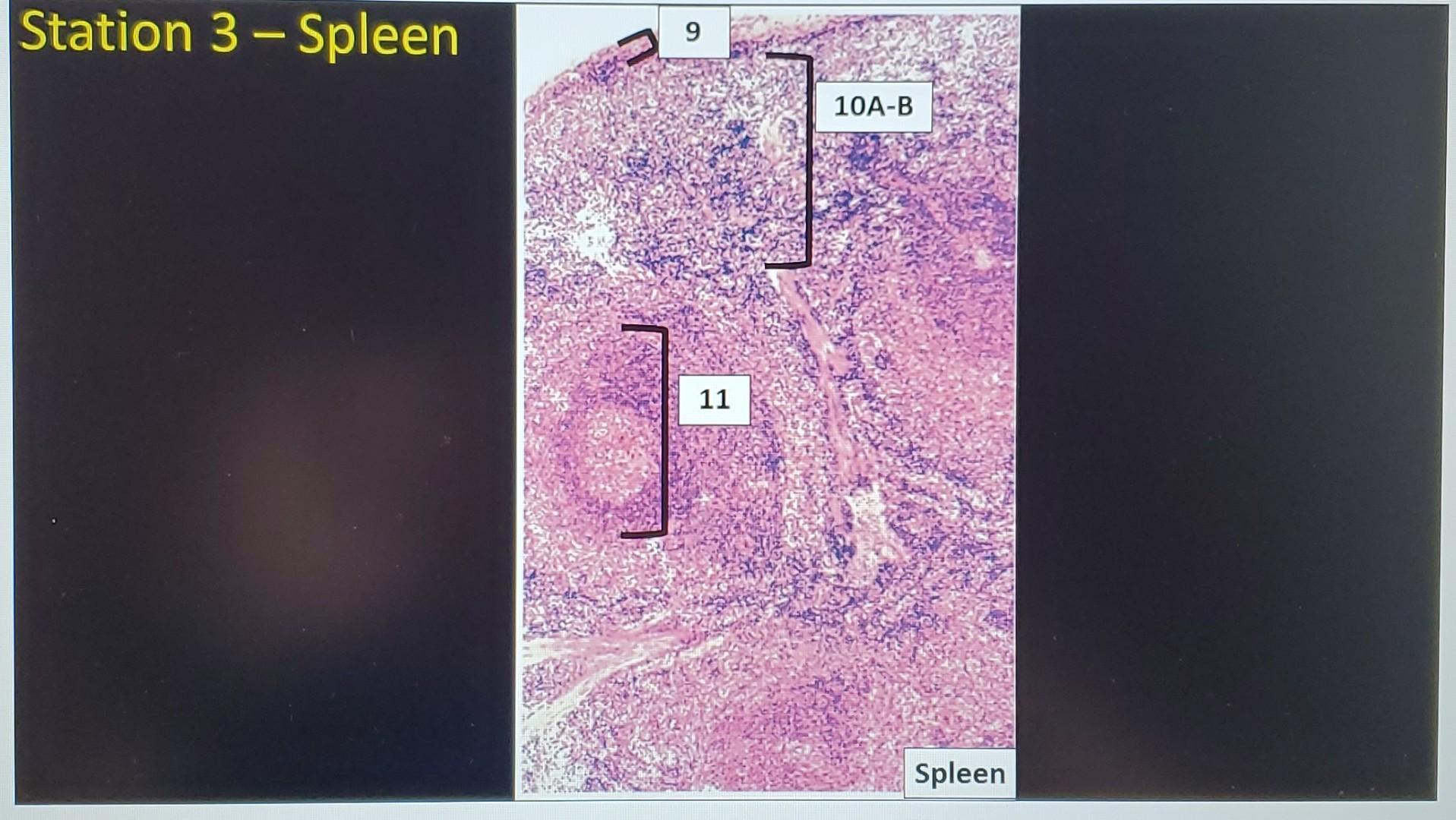 Solved Station 3Spleen 9 1 11 10AB Spleen