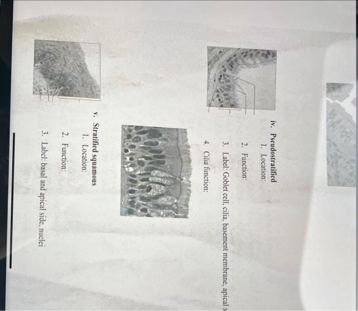 iv. Pseudostratified
1. Location:
2. Function:
3. Label: Goblet cell, cilia, basement membrane, apical
4. Cilia function:
v. 