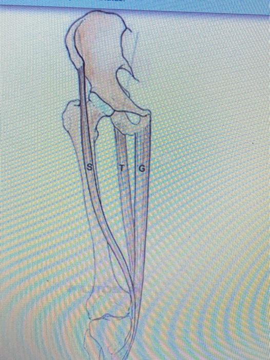 Solved SI G The Tripod Muscles of the Thigh all insert on