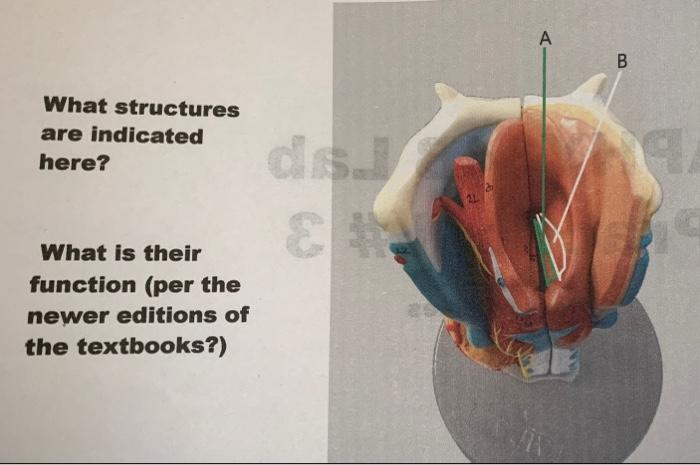 Solved A B What Structures Are Indicated Here? ♡ What Is | Chegg.com