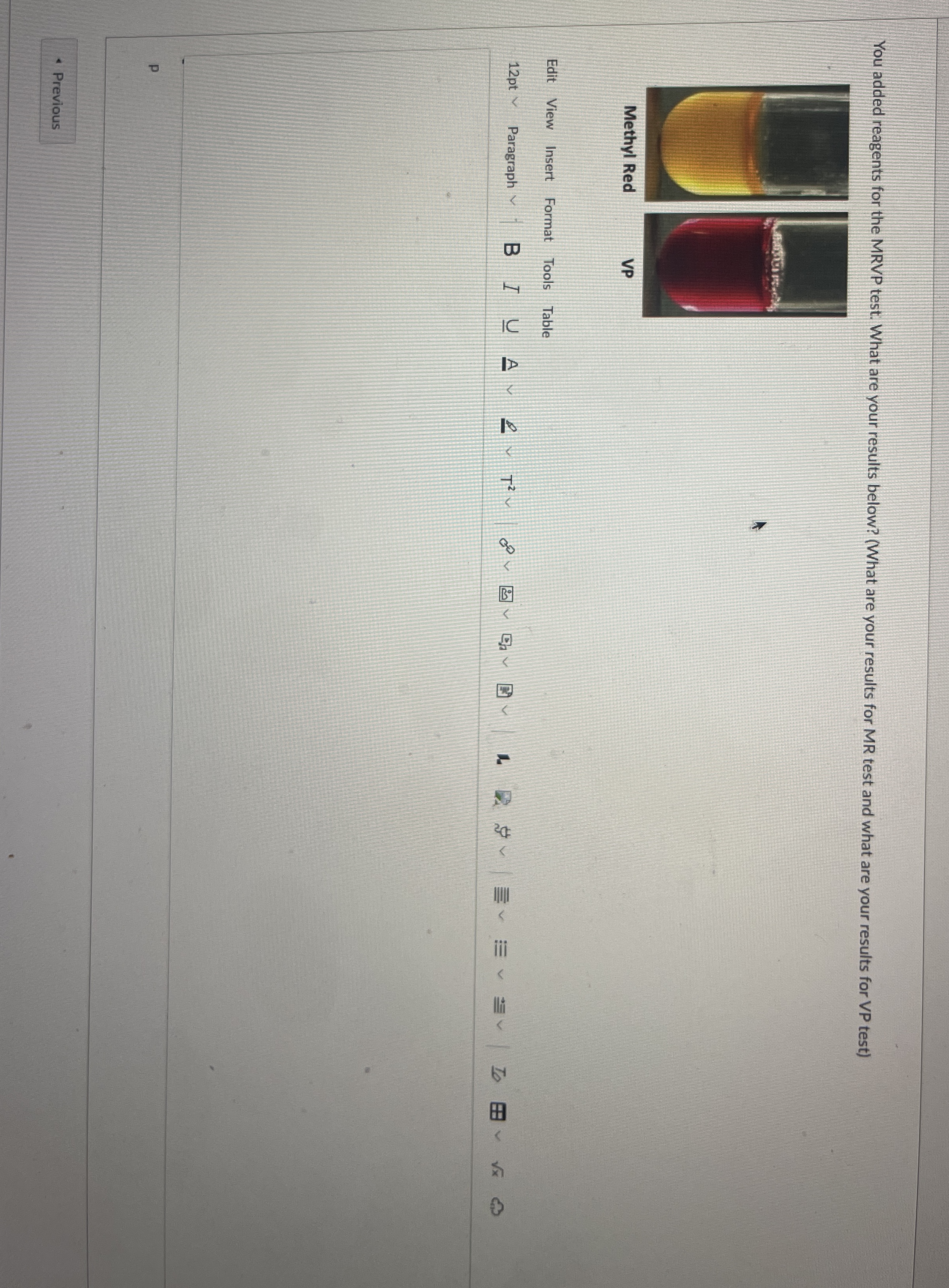 solved-by-an-expert-you-added-reagents-for-the-mrvp-test-what-are-your