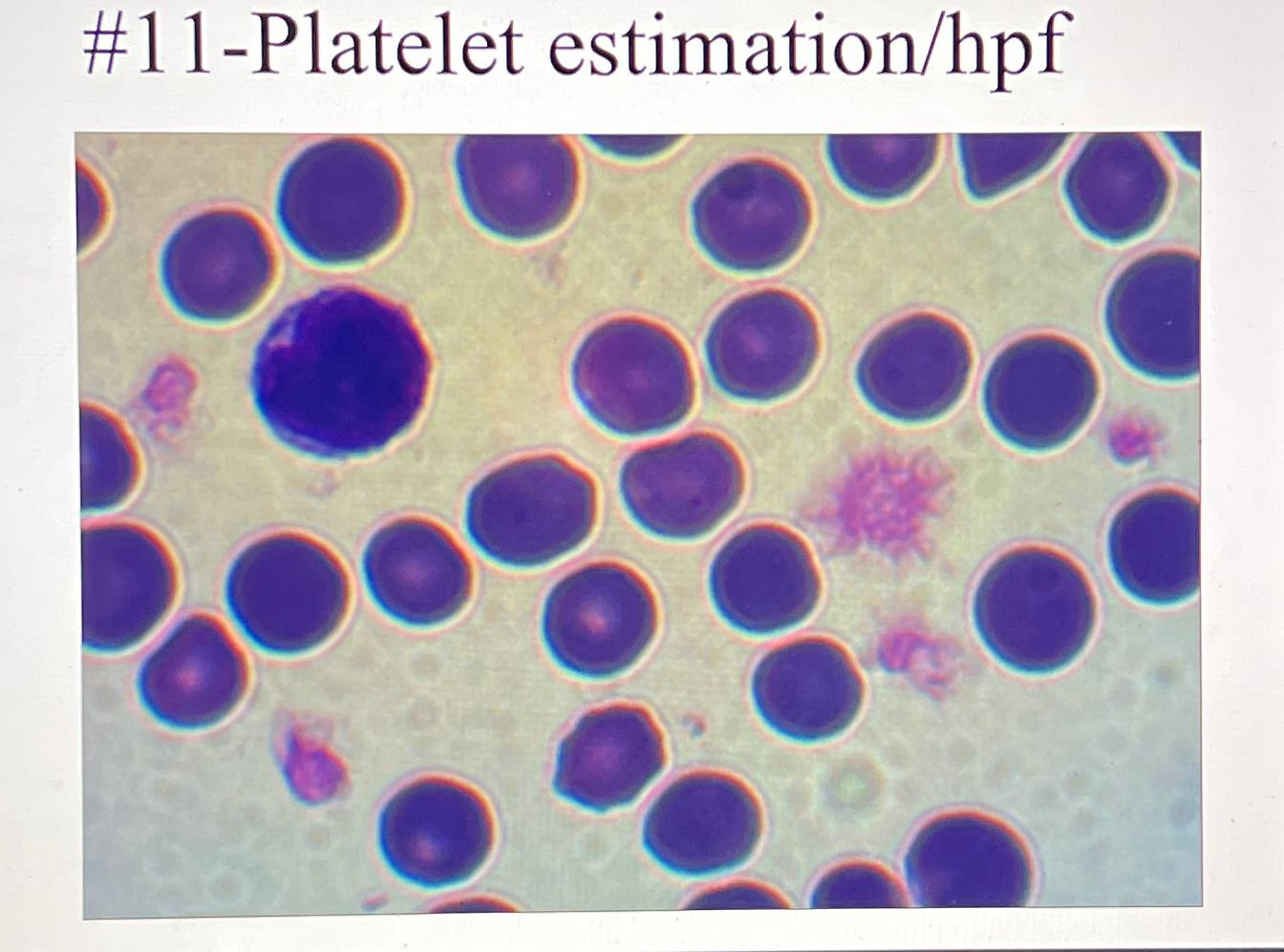 Solved 11 ﻿Platelet estimation/hpf