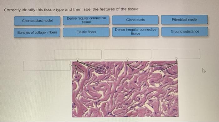 Correctly Identify This Tissue Type And Quiz 2182