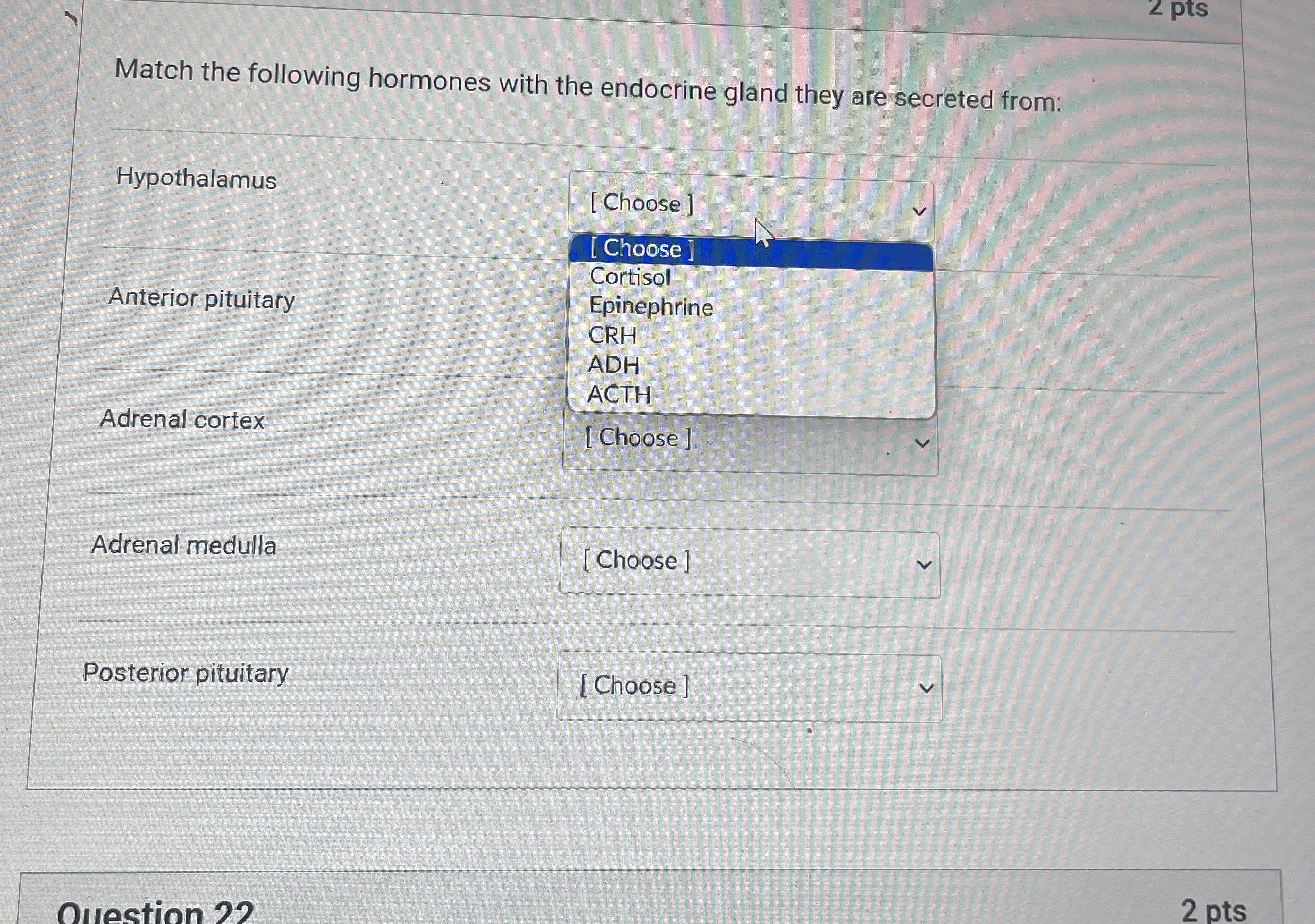 Solved Match the following hormones with the endocrine gland | Chegg.com