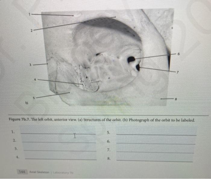 Solved 3 Figure 7b.7. The left orbit, anterior view. (a) | Chegg.com