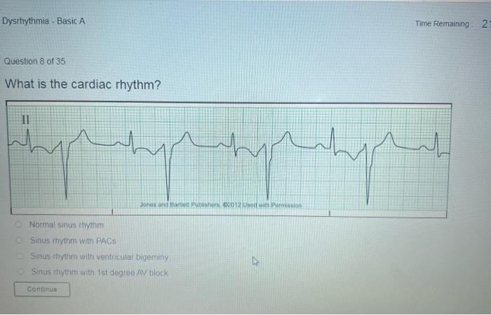 Dysrhythmia - Basic A
Time Remaining - \( 2 i \)
Question 8 of 35
What is the cardiac rhythm?
Sinus thythm with PACs
Sinus th